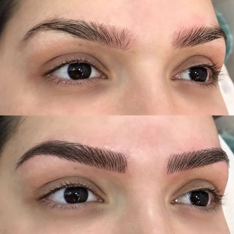 Eyebrow Tattoos Are Helping People With Hair Loss